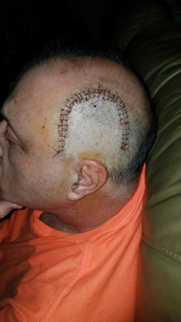 Mauricio Headshot with stitches